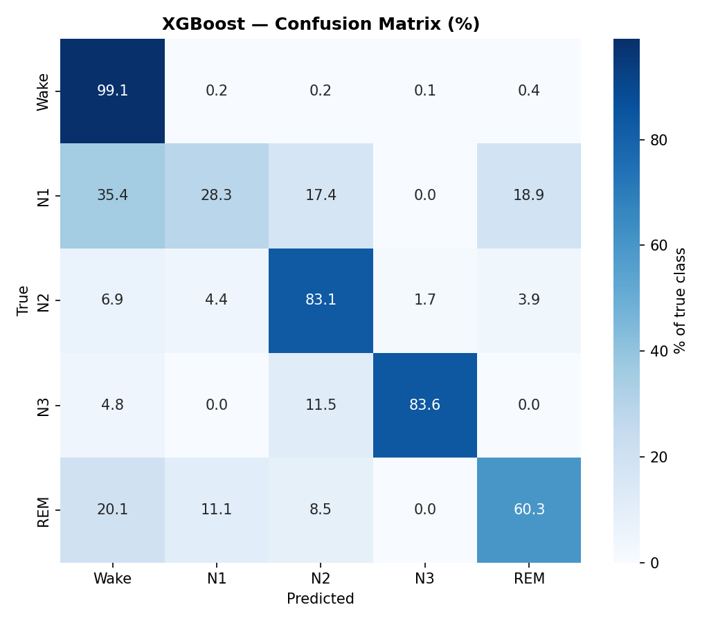 XGBoost confusion matrix