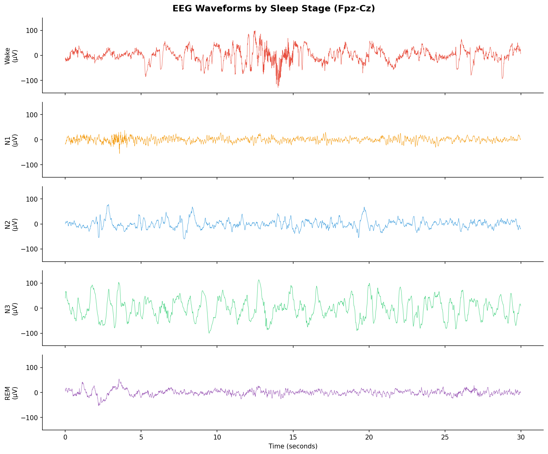 EEG waveforms by sleep stage