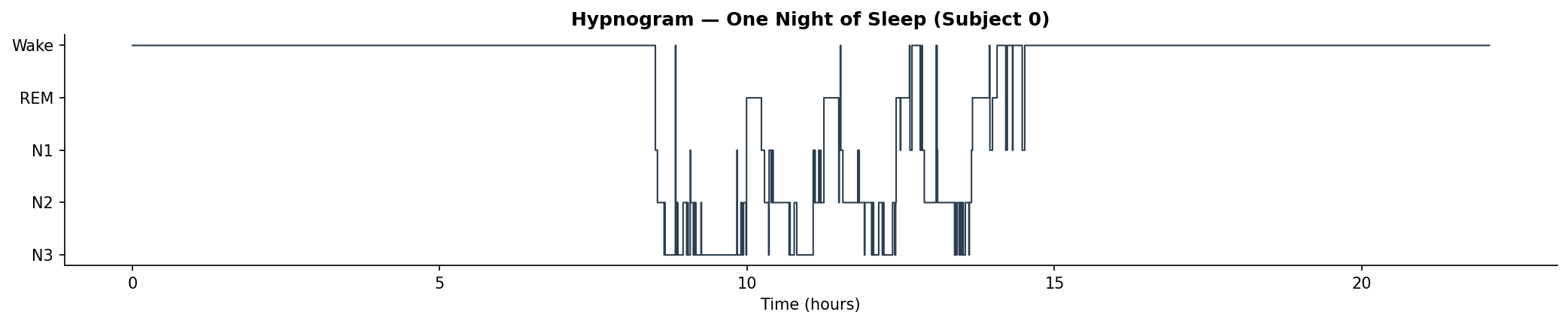 Hypnogram of one night of sleep